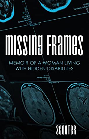 Read Online Missing Frames: Memoir of a Woman Living with Hidden Disabilities - Scooter file in ePub